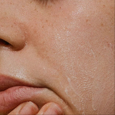 Dryness & Flakiness